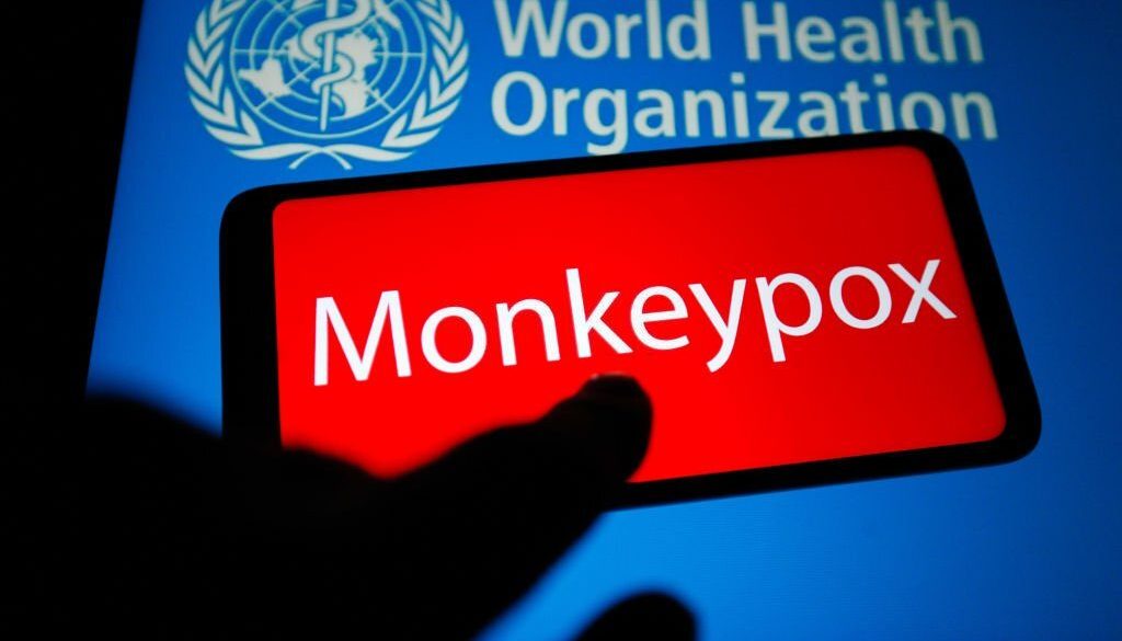 Dalam ilustrasi foto ini, kata Monkeypox terlihat di layar smartphone dengan logo Organisasi Kesehatan Dunia (WHO) di latar belakang. (Ilustrasi Foto oleh Pavlo Gonchar/SOPA Images/LightRocket via Getty Images)